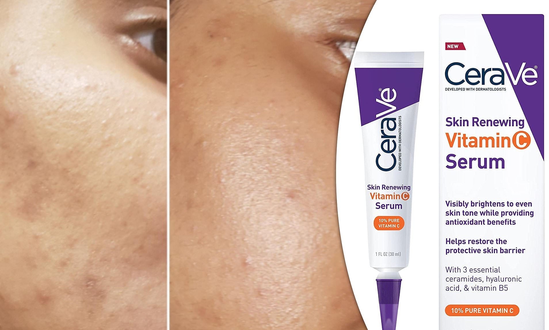 CeraVe Skin Renewing Vitamin C serum - 30ml